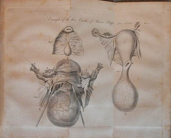 female organs used in medical books